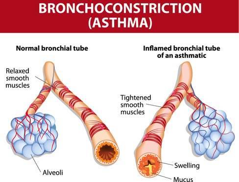 Supporting AsthmaCoalitionNWM’s Mission